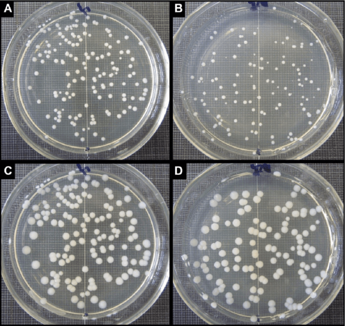 Cfu colony streak plates cfus counts