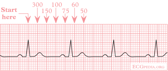 Cara menghitung hr ekg