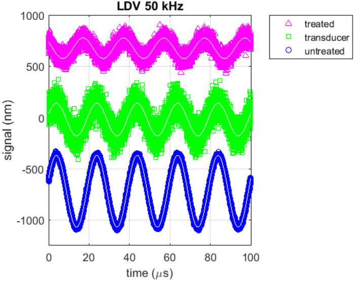 Vibrations vibrating molecules wave vibrate produced pushed causes vibrates ears