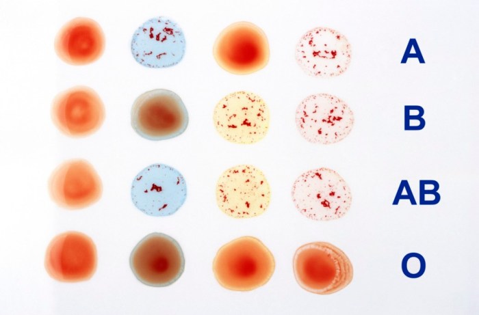 Blood typing type anatomy test types chart rh lab ab card positive negative cards notes biologycorner usmle work factor kit