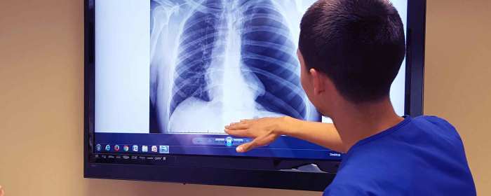 Radiology diploma leverageedu