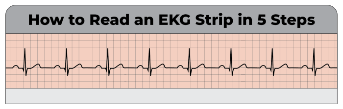 Cara menghitung ekg