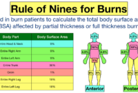 Cara menghitung luka bakar