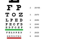 Cara menghitung snellen chart